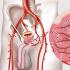 Эмболизация артерий простаты: преимущества и особенности проведения